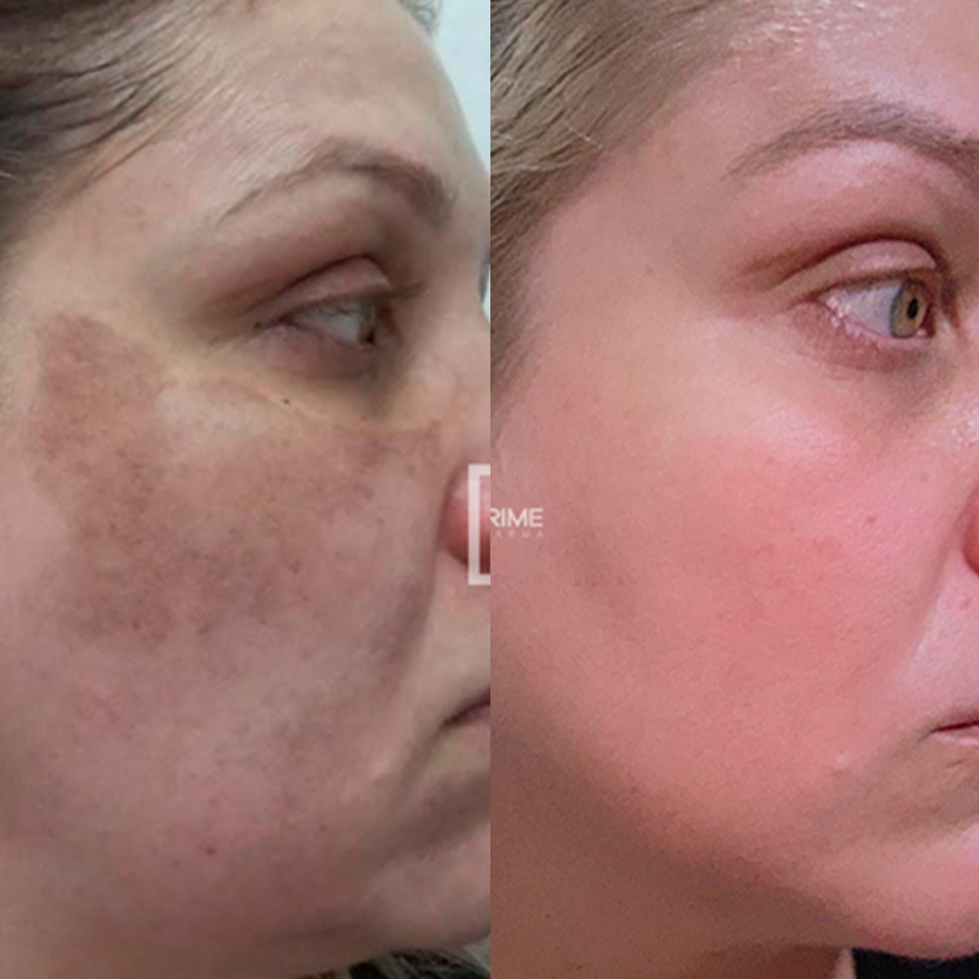 Resultado de aluno com protocolos ensinados